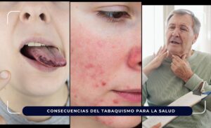Consecuencias del tabaquismo para la Salud
