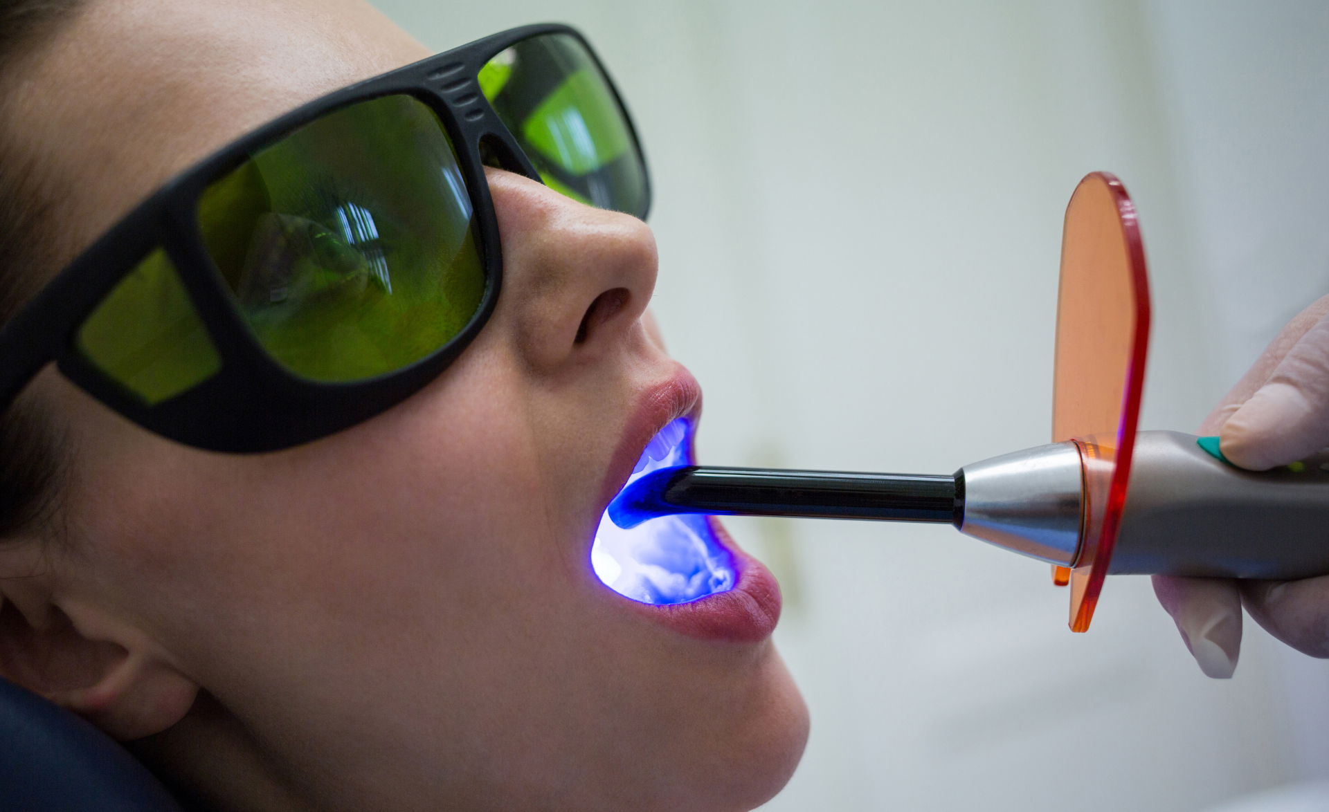 Láser para Dejar de Fumar: Efectividad y Beneficios